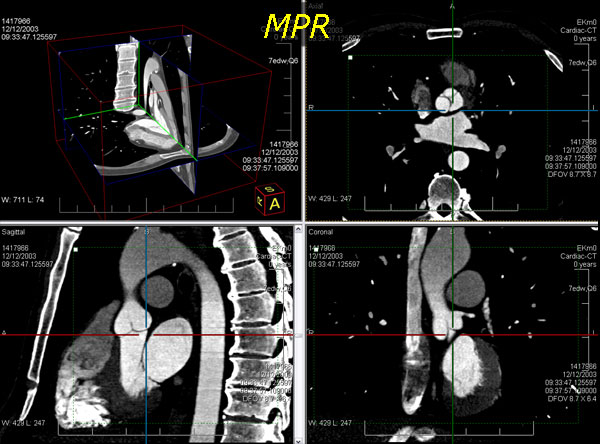 3d volume screenshot