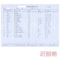 模糊照片检测报告识别对比